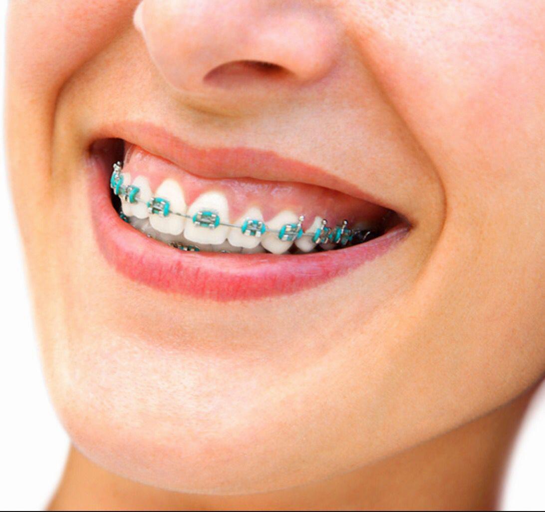 hallandale beach orthodontist