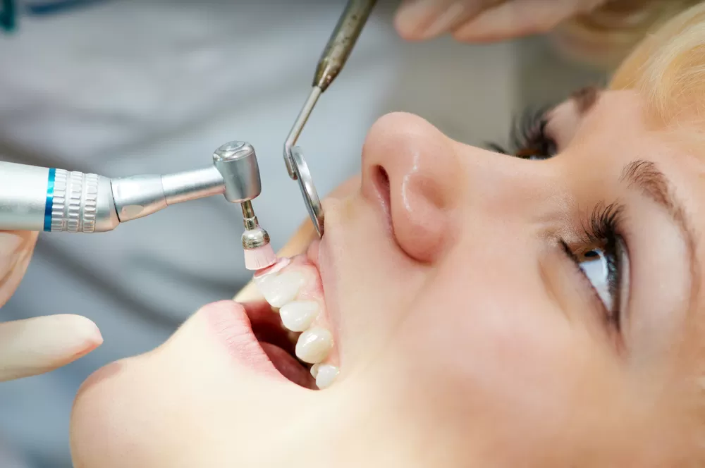 deep cleaning teeth
